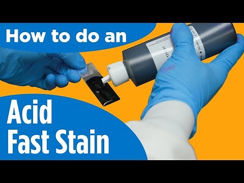 How to do an Acid-Fast Stain - Instructions for the lab/procedure
