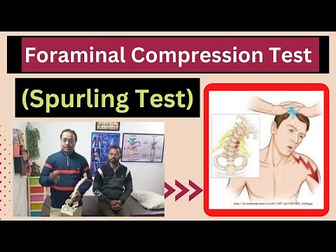 Spurling Test-Foraminal Compression Test|Cervical pain|Nerve root Pain|Physiotherpy|healtheducatum