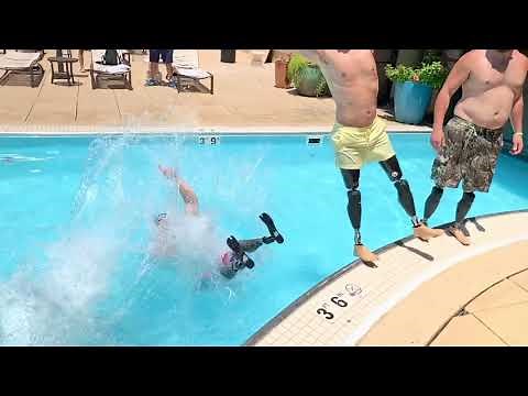 Bilateral Amputee: ALIVE