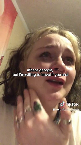 Help Fix my Teeth on TikTok