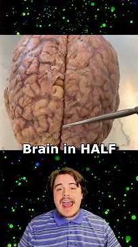 Split Brain Test Changes Everything 🧠
