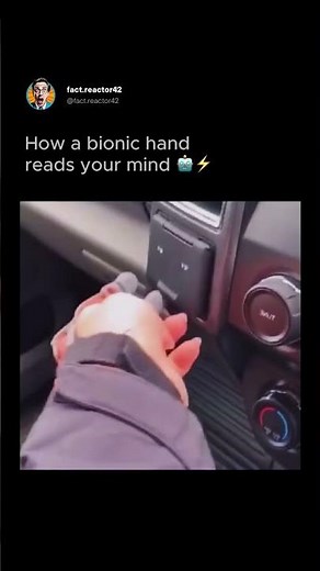 ✨ How a Bionic Hand Actually Works – Real-Life Cyborg Tech