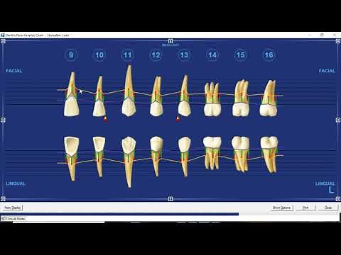 Dentrix Perio Chart Features by Practice Strategies