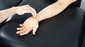 Tinel Sign of the Wrist | Carpal Tunnel Syndrome Assessment