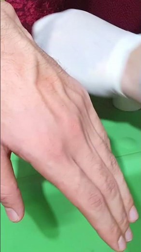 How to Insert IV Cannula | IV Cannulation Technique | Branula | Intravenous Catheter