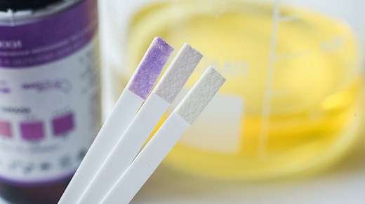 What Medications Cause False-Positive Drug Tests? - GoodRx