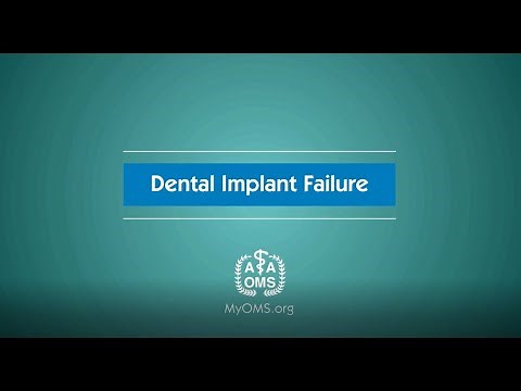 Dental Implant Failure