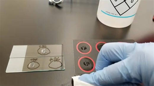Slide coagulase testing 😍😍 #lablife #microbiology #medicallaboratoryscience | Lab life
