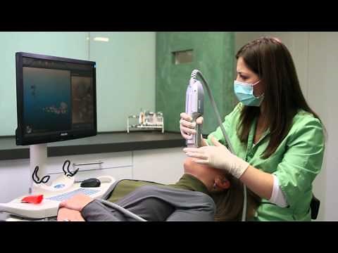 iTero Invisalign Scanning Protocols