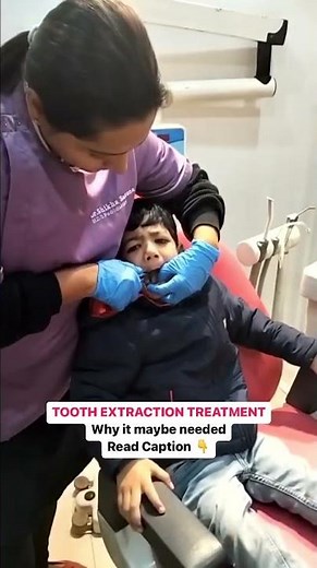 Tooth Extraction Treatment for Kids (Safe & Easy)