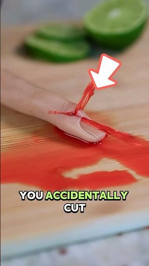 How to Bandage a Finger Injury in Seconds!