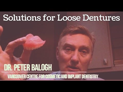 Solutions for Loose Dentures | VCCID