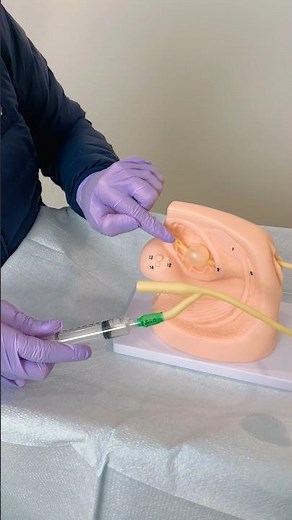Understanding how a Foley catheter works🏥 #nursingstudent #foleyanatomy