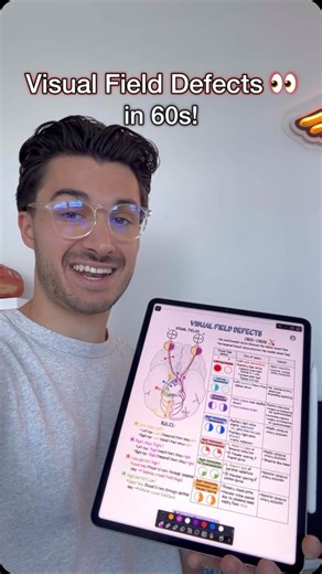 151 reactions · 37 shares | Easy trick for Visual Field Defects ❌ Save this from my Neurology & Special Senses Guide  #medstudent #medschool #medicalschool #medicalstudent #usmle #usmlestep1 #neurology #opthalmology | Medschoolbro | Facebook