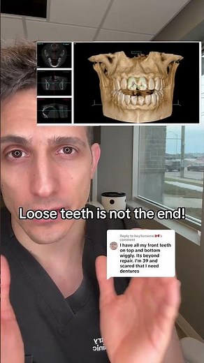 If your front teeth are loose, will you lose them?