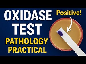 Oxidase Test | Pathology Practical | Principle, Methods & Results | MBBS