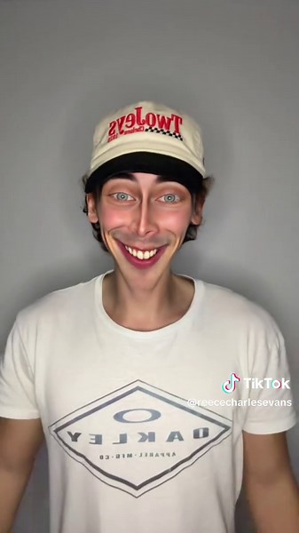 Melbourne Street Performers: Hilarious Fail Moments