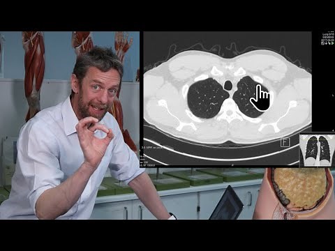 Thorax transverse CT imaging