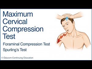 Maximum Cervical Compression Test (Spurling’s Test) - A Chiropractic Online CE™ Production
