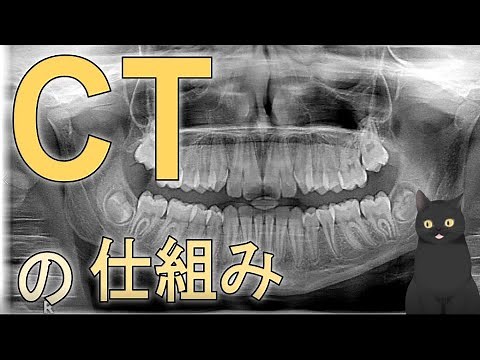 【10分で解説】図解：CTの仕組み