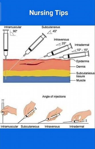 Angles of Insertion of Injection IM/SC/IV/ID #nurse #tips #medical