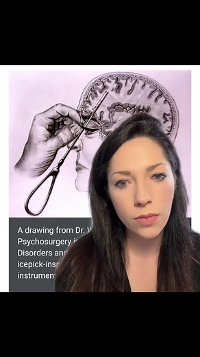 Understanding Lobotomies: Explained and Demystified