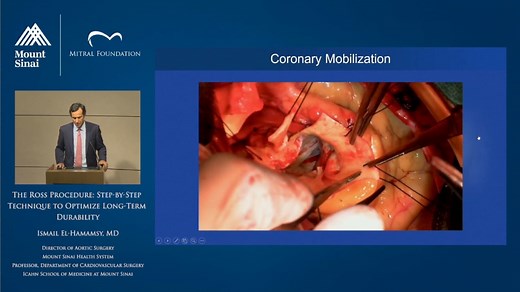 The Ross Procedure: Step-by-Step Technique to Optimize Long-term Durability - Physician's Channel - Mount Sinai New York
