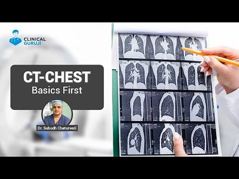 CT Chest - Basics First