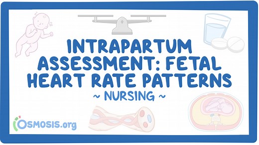 Intrapartum assessment - Fetal heart rate patterns: Nursing: Video & Causes | Osmosis
