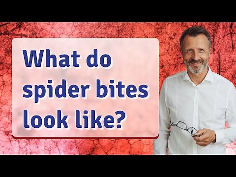 What do spider bites look like?