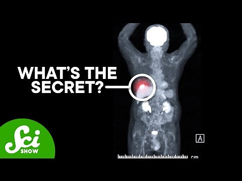 How PET Scans See Cancer