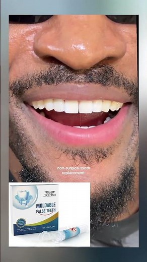 Fix Missing Teeth Fast! Fix your broken teeth at home easily. Smile Repair & Whitening in Seconds!