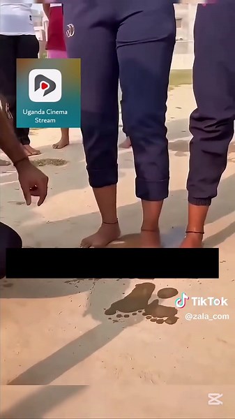 Understanding Flat Feet: Causes and Solutions