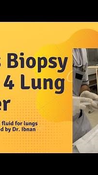 How to take Pleural Fluid Sample - Lungs Biopsy for Stage 4 Lungs Cancer Patient