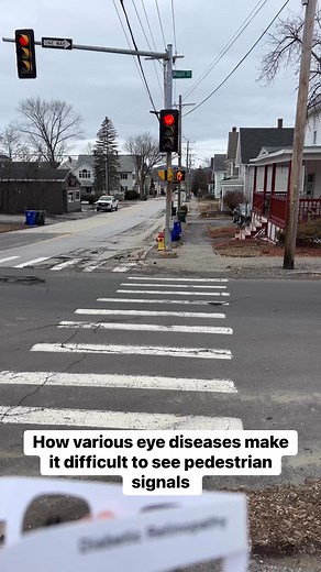 In this video, I demonstrate how various eye conditions can impact a person’s ability to see crosswalk signals by using simulation glasses that replicate different types of vision loss, including macular degeneration, glaucoma, diabetic retinopathy, CMV retinitis, and cataracts. These simulations provide a clearer understanding of the visual barriers many individuals face and emphasize the importance of accessible pedestrian features such as audible signals and high-contrast indicators. Raising