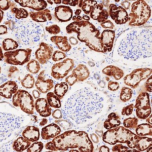 Immunohistochemistry: An Overview + Steps to Better IHC Staining