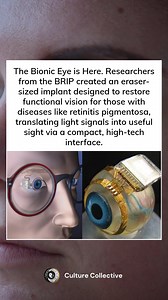 3.2K views · 26 reactions | The future of vision is here. Thanks to groundbreaking research, the Bionic Eye is set to restore sight for those affected by diseases like retinitis pigmentosa. A small, powerful implant that translates light into sight—bringing hope to millions. ️ #BionicEye #InnovationInSight #TechForGood #FutureOfVision | Culture Collective | Facebook