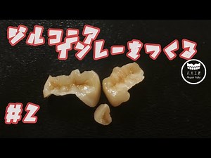 【歯科技工】口腔内スキャナーでジルコニアインレーを作る#2