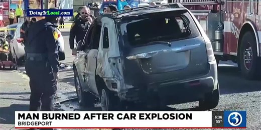 Man severely burned after car explosion