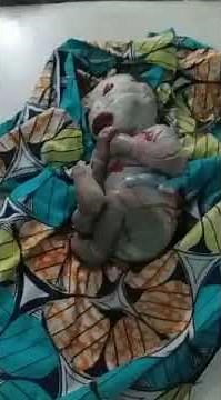 Strangest baby born: #Alien like baby born in Nigeria ( The Nomo/ #Reptilian)