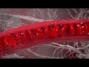 Blood brain barrier - microbubbles for drug delivery