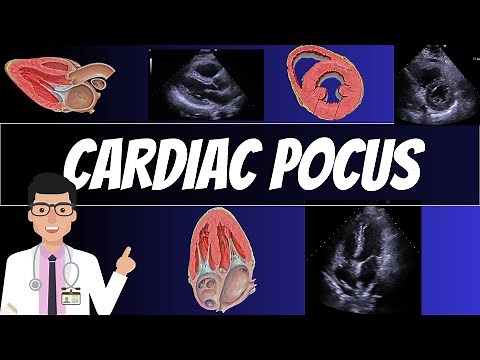 CARDIAC POINT OF CARE ULTRASOUND (POCUS)