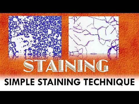 Simple staining technique / Principle / Procedure and Applications / Microbiological Insights