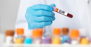 Normal cholesterol: High HDL levels may not protect the heart