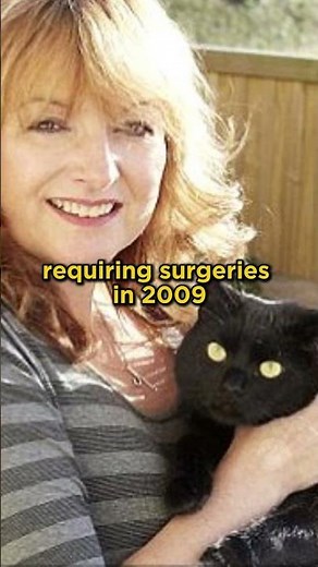 Cat with Robot Legs: Oscar, the World's First Bionic Cat #cats