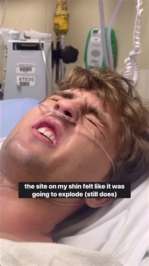 i can’t believe it’s already been a year since this life changing bite. thanks for the support ❤️