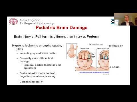 An Overview of Cerebral Vision Impairment