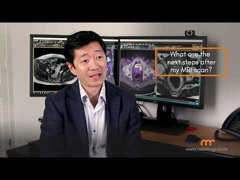 Prostate Cancer Screening - MRI Prostate Scans | Mercy Radiology