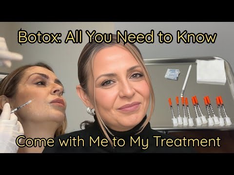 BOTOX: Everything you need to know! My Botox Experience: Expert Tips & Insights from My Injector
