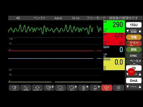 心電図モニター シュミレーション 心室細動V FIB→心拍再開
